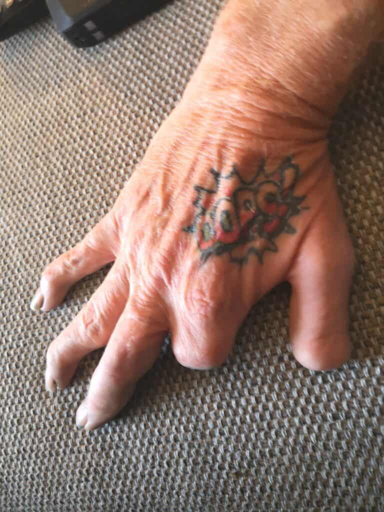 finger missing from camping accident oops tattoo on hand